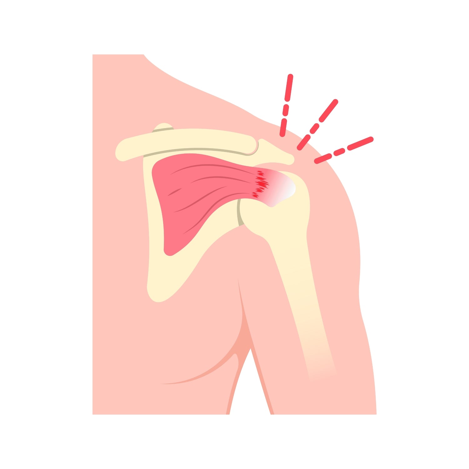 Bones & Joints & Muscles