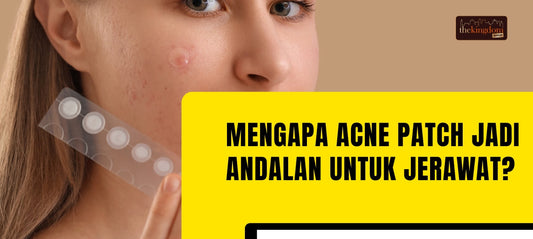 Mengapa Acne Patch Jadi Andalan untuk Jerawat? Temukan Faktanya!